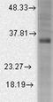 Potassium Calcium-Activated Channel Subfamily M Regulatory Beta Subunit 3 antibody, GTX42009, GeneTex, Western Blot image 