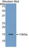 Inhibin Subunit Beta A antibody, LS-C294609, Lifespan Biosciences, Western Blot image 