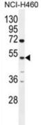 Carboxypeptidase A6 antibody, abx026209, Abbexa, Western Blot image 