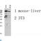 Glutamate Ionotropic Receptor NMDA Type Subunit 2D antibody, LS-C813424, Lifespan Biosciences, Western Blot image 
