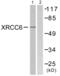 X-Ray Repair Cross Complementing 6 antibody, abx013259, Abbexa, Western Blot image 