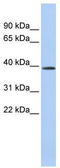 Ceroid-lipofuscinosis neuronal protein 6 antibody, TA342044, Origene, Western Blot image 