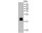 NME/NM23 Nucleoside Diphosphate Kinase 1 antibody, NBP2-76900, Novus Biologicals, Western Blot image 