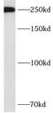 Activating signal cointegrator 1 complex subunit 3 antibody, FNab00629, FineTest, Western Blot image 