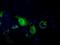 Pantothenate Kinase 2 antibody, GTX83944, GeneTex, Immunocytochemistry image 