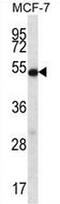 Coilin antibody, AP51008PU-N, Origene, Western Blot image 