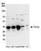 Tetratricopeptide Repeat Domain 33 antibody, A304-701A, Bethyl Labs, Western Blot image 