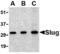 Snail Family Transcriptional Repressor 2 antibody, MBS150130, MyBioSource, Western Blot image 