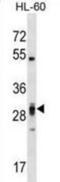 Pleckstrin Homology And FYVE Domain Containing 2 antibody, abx029090, Abbexa, Western Blot image 