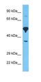 Gamma-Aminobutyric Acid Type A Receptor Alpha6 Subunit antibody, orb324588, Biorbyt, Western Blot image 