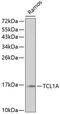 T Cell Leukemia/Lymphoma 1A antibody, GTX16378, GeneTex, Western Blot image 