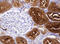 Gamma-Butyrobetaine Hydroxylase 1 antibody, LS-C787857, Lifespan Biosciences, Immunohistochemistry paraffin image 