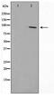 SUMO Specific Peptidase 5 antibody, TA347493, Origene, Western Blot image 