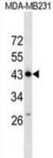 Zinc Finger Protein 550 antibody, abx029922, Abbexa, Western Blot image 