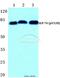 Lymphocyte Cytosolic Protein 2 antibody, A04880Y128, Boster Biological Technology, Western Blot image 