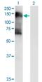 Salt Inducible Kinase 2 antibody, H00023235-M03, Novus Biologicals, Western Blot image 