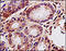 Mucin 5AC, Oligomeric Mucus/Gel-Forming antibody, 251394, Abbiotec, Immunohistochemistry paraffin image 