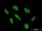 Zinc Finger And BTB Domain Containing 48 antibody, H00003104-B01P-50ug, Novus Biologicals, Immunofluorescence image 