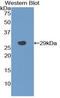 Toll Like Receptor 6 antibody, LS-C296709, Lifespan Biosciences, Western Blot image 