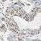 Ubiquitin Specific Peptidase 28 antibody, NBP1-82904, Novus Biologicals, Immunohistochemistry paraffin image 