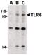 Toll Like Receptor 6 antibody, PA5-20187, Invitrogen Antibodies, Western Blot image 