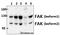 Protein Tyrosine Kinase 2 antibody, A00151Y570, Boster Biological Technology, Western Blot image 
