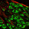 Glutamate Metabotropic Receptor 5 antibody, A01338, Boster Biological Technology, Western Blot image 