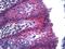 Junction Plakoglobin antibody, LS-B5281, Lifespan Biosciences, Immunohistochemistry paraffin image 