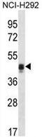 Calumenin antibody, AP50717PU-N, Origene, Western Blot image 