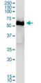 Dihydropyrimidinase Like 4 antibody, H00010570-B01P, Novus Biologicals, Western Blot image 