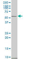 Calcium/Calmodulin Dependent Protein Kinase II Alpha antibody, LS-C196810, Lifespan Biosciences, Western Blot image 