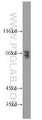 E3 ubiquitin-protein ligase TRIM32 antibody, 10326-1-AP, Proteintech Group, Western Blot image 