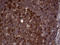 RAB23, Member RAS Oncogene Family antibody, LS-C799644, Lifespan Biosciences, Immunohistochemistry paraffin image 