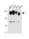 Carcinoembryonic Antigen Related Cell Adhesion Molecule 5 antibody, A00356-1, Boster Biological Technology, Western Blot image 
