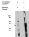 Delta 4-Desaturase, Sphingolipid 2 antibody, MBS395537, MyBioSource, Western Blot image 