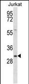 Transmembrane P24 Trafficking Protein Family Member 8 antibody, PA5-48724, Invitrogen Antibodies, Western Blot image 