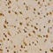 Mtr4 Exosome RNA Helicase antibody, LS-B14897, Lifespan Biosciences, Immunohistochemistry frozen image 