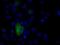Natriuretic Peptide Receptor 3 antibody, NBP2-02401, Novus Biologicals, Immunocytochemistry image 