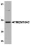 Transmembrane Protein 184C antibody, NBP1-77144, Novus Biologicals, Western Blot image 