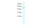 Regulator Of G Protein Signaling 6 antibody, 27-989, ProSci, Western Blot image 