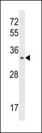 TP53 Induced Glycolysis Regulatory Phosphatase antibody, LS-C157194, Lifespan Biosciences, Western Blot image 