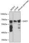 Glutamate Decarboxylase 1 antibody, 18-876, ProSci, Western Blot image 