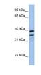 FKBP Prolyl Isomerase 8 antibody, NBP1-59018, Novus Biologicals, Western Blot image 