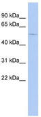 Gamma-Aminobutyric Acid Type A Receptor Alpha4 Subunit antibody, TA338503, Origene, Western Blot image 