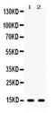 ISG15 Ubiquitin Like Modifier antibody, PB9950, Boster Biological Technology, Western Blot image 