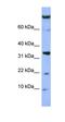 Family With Sequence Similarity 178 Member B antibody, orb326137, Biorbyt, Western Blot image 