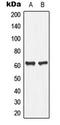 Phospholipase A2 Group IVC antibody, LS-C354114, Lifespan Biosciences, Western Blot image 