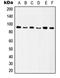 Integrin Subunit Beta 5 antibody, orb214127, Biorbyt, Western Blot image 
