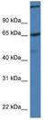 ST6 N-Acetylgalactosaminide Alpha-2,6-Sialyltransferase 1 antibody, NBP1-79210, Novus Biologicals, Western Blot image 