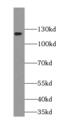 Palladin, Cytoskeletal Associated Protein antibody, FNab06127, FineTest, Western Blot image 